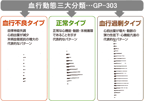 GP-303　結果イメージ