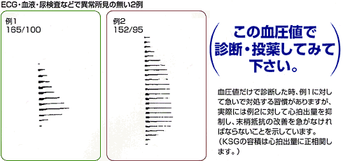 GP-303　結果イメージ２